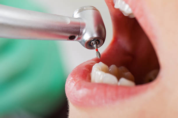 Best Pediatric Emergency Dentist in Lake Forest, IL